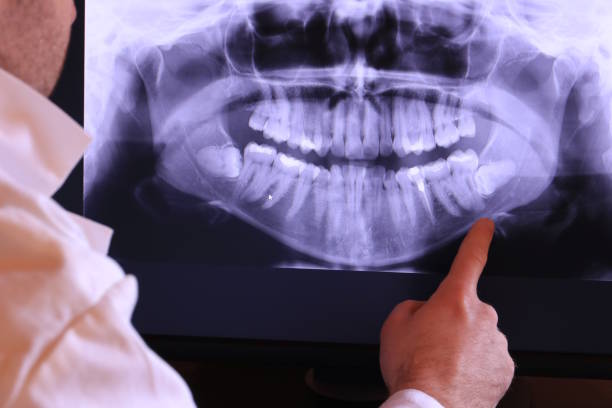 Best Broken or Chipped Tooth Repair in Perry, IA