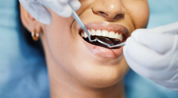 Best Emergency Dental Care for Sports Injuries in Perry, IA